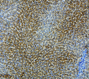 Anti-CYP2E1 antibody used in IHC (Paraffin sections) (IHC-P). GTX12194
