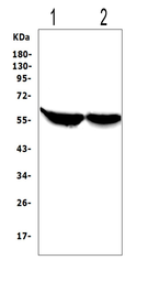 Anti-CYP2E1 antibody used in Western Blot (WB). GTX12194