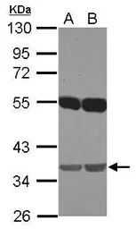 Anti-EMB antibody [N1C1] used in Western Blot (WB). GTX121953