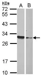Anti-HMGB4 antibody used in Western Blot (WB). GTX121968