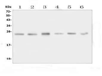 Anti-FSTL3 antibody used in Western Blot (WB). GTX12198