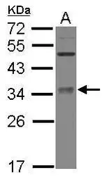 Anti-METTL6 antibody [N1C3] used in Western Blot (WB). GTX121980