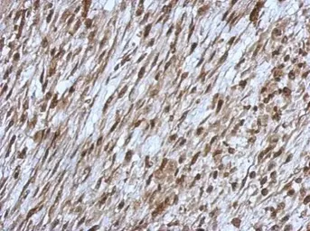Anti-OSBPL9 antibody [C2C3], C-term used in IHC (Paraffin sections) (IHC-P). GTX121992