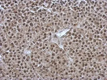 Anti-OSBPL9 antibody [C2C3], C-term used in IHC (Paraffin sections) (IHC-P). GTX121992