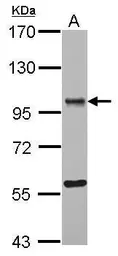 Anti-OSBPL9 antibody [C2C3], C-term used in Western Blot (WB). GTX121992