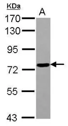 Anti-POLR3E antibody used in Western Blot (WB). GTX121999