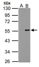 Anti-PPP4R2 antibody used in Western Blot (WB). GTX122000