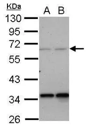 Anti-PPP4R2 antibody used in Western Blot (WB). GTX122000