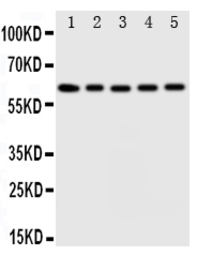 Anti-IDS antibody used in Western Blot (WB). GTX12202