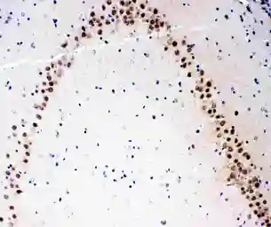 Anti-MEKK3 antibody used in IHC (Paraffin sections) (IHC-P). GTX12204