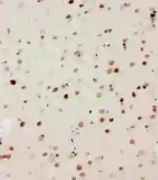 Anti-MEKK3 antibody used in IHC (Paraffin sections) (IHC-P). GTX12204