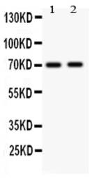 Anti-MEKK3 antibody used in Western Blot (WB). GTX12204