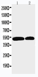 Anti-NOXA1 antibody used in Western Blot (WB). GTX12206