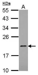 Anti-MRPL21 antibody [N1C3] used in Western Blot (WB). GTX122070