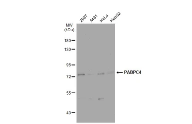 Anti-PABPC4 antibody used in Western Blot (WB). GTX122079