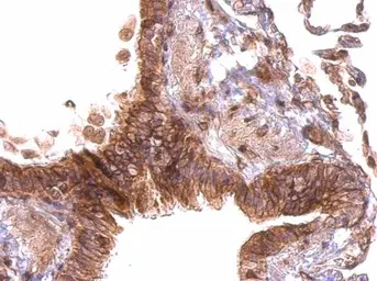 Anti-PABPC4 antibody used in IHC (Paraffin sections) (IHC-P). GTX122079