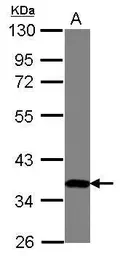 Anti-ZNF177 antibody [N3C3] used in Western Blot (WB). GTX122093