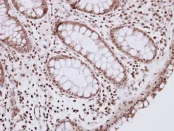 Anti-R3HDM2 antibody [N3C2], Internal used in IHC (Paraffin sections) (IHC-P). GTX122103