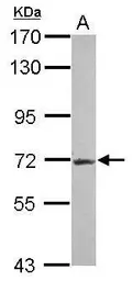Anti-R3HDM2 antibody [N3C2], Internal used in Western Blot (WB). GTX122103