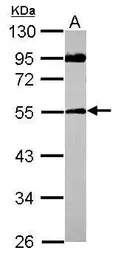 Anti-SPAG8 antibody used in Western Blot (WB). GTX122115