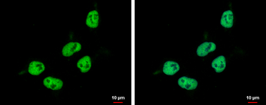 Anti-ZNF329 antibody used in Immunocytochemistry/ Immunofluorescence (ICC/IF). GTX122136