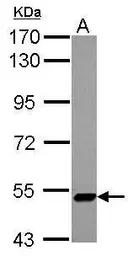 Anti-ZNF329 antibody used in Western Blot (WB). GTX122136