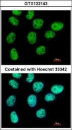 Anti-ZNF503 antibody [C2C3], C-term used in Immunocytochemistry/ Immunofluorescence (ICC/IF). GTX122143