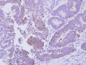 Anti-CG1458 antibody used in IHC (Paraffin sections) (IHC-P). GTX122151