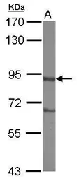 Anti-DISC1 antibody [C2C3], C-term used in Western Blot (WB). GTX122158
