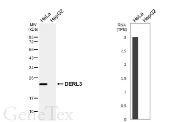 Anti-DERL3 antibody [N3C2], Internal used in Western Blot (WB). GTX122163