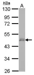 Anti-CERD4 antibody [N1C1] used in Western Blot (WB). GTX122249