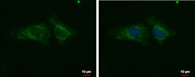 Anti-PHACTR1 antibody used in Immunocytochemistry/ Immunofluorescence (ICC/IF). GTX122251