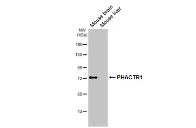 Anti-PHACTR1 antibody used in Western Blot (WB). GTX122251