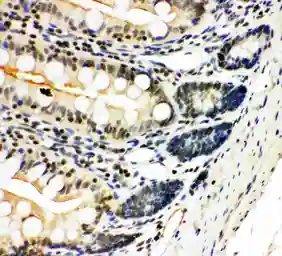 Anti-NFkB p100/p52 antibody used in IHC (Paraffin sections) (IHC-P). GTX12226