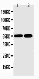 Anti-NFkB p100/p52 antibody used in Western Blot (WB). GTX12226