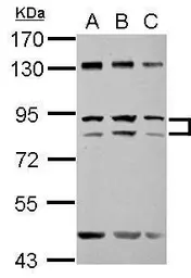Anti-ZFY antibody [N1N2], N-term used in Western Blot (WB). GTX122296