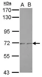 Anti-ZNF248 antibody [N1N3] used in Western Blot (WB). GTX122307