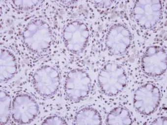 Anti-ZNF418 antibody [N2C1], Internal used in IHC (Paraffin sections) (IHC-P). GTX122331