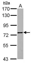Anti-ZNF418 antibody [N2C1], Internal used in Western Blot (WB). GTX122331
