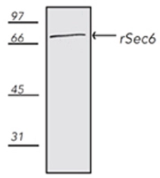 Anti-SEC6 antibody [9H5] used in Western Blot (WB). GTX12235