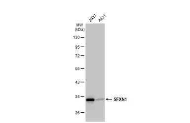 Anti-SFXN1 antibody used in Western Blot (WB). GTX122365