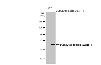 Anti-GALNT14 antibody [N1N3] used in Western Blot (WB). GTX122371