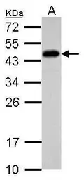 Anti-SCML4 antibody used in Western Blot (WB). GTX122421