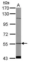 Anti-CDADC1 antibody [C1C3] used in Western Blot (WB). GTX122442