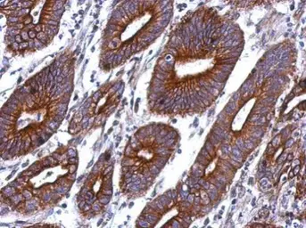 Anti-CTAGE1 antibody [N3C2], Internal used in IHC (Paraffin sections) (IHC-P). GTX122445