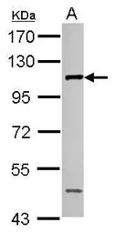 Anti-CTAGE1 antibody [N3C2], Internal used in Western Blot (WB). GTX122445