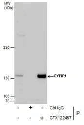 Anti-CYFIP1 antibody [N1N2], N-term used in Immunoprecipitation (IP). GTX122467
