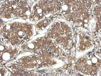 Anti-CYFIP1 antibody [N1N2], N-term used in IHC (Paraffin sections) (IHC-P). GTX122467