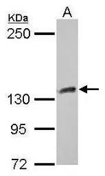 Anti-CYFIP1 antibody [N1N2], N-term used in Western Blot (WB). GTX122467