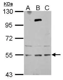 Anti-ZNF513 antibody used in Western Blot (WB). GTX122468